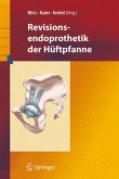 Revisionsendoprothetik der Hüftpfanne (eBook, PDF)