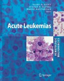 Hematologic Malignancies: Acute Leukemias (eBook, PDF)