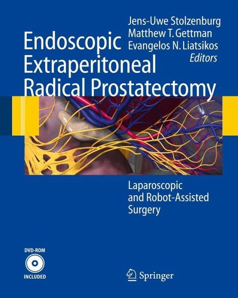 Endoscopic Extraperitoneal Radical Prostatectomy (eBook, PDF) Endoscopic Extraperitoneal Radical Prostatectomy (eBook, PDF)