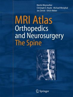 MRI Atlas (eBook, PDF) - Weyreuther, Martin; Heyde, Christoph E.; Westphal, Michael; Zierski, Jan; Weber, Ulrich