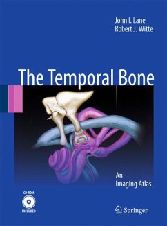 Temporal Bone (eBook, PDF) - Lane, John I.; Witte, Robert J.