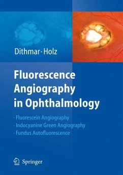 Fluorescence Angiography in Ophthalmology (eBook, PDF) - Dithmar, Stefan; Holz, Frank G.