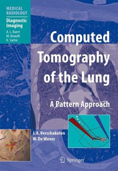 Computed Tomography of the Lung (eBook, PDF) - Verschakelen, Johny A.; de Wever, Walter