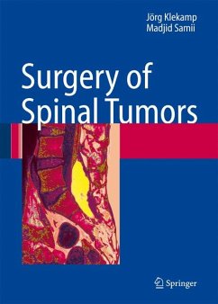 Surgery of Spinal Tumors (eBook, PDF) - Klekamp, Jörg; Samii, Madjid