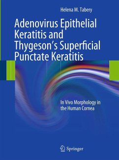 Adenovirus Epithelial Keratitis and Thygeson's Superficial Punctate Keratitis (eBook, PDF) - Tabery, Helena M.