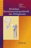 Modulare Revisionsendoprothetik des Hüftgelenks (eBook, PDF)