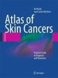 Atlas of Skin Cancers (eBook, PDF) - Bild 1