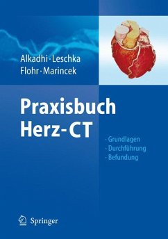 Praxisbuch Herz-CT (eBook, PDF)