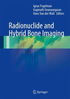 Radionuclide and Hybrid Bone Imaging (eBook, PDF)