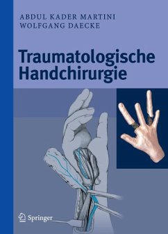 Traumatologische Handchirurgie (eBook, PDF) - Martini, Abdul Kader; Daecke, Wolfgang