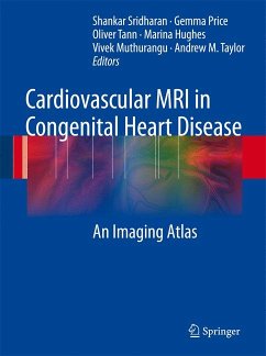 Cardiovascular MRI in Congenital Heart Disease (eBook, PDF) - Sridharan, Shankar; Price, Gemma; Tann, Oliver; Hughes, Marina; Muthurangu, Vivek; Taylor, Andrew M.
