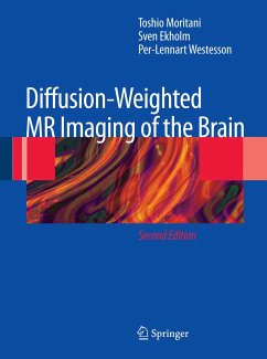 Diffusion-Weighted MR Imaging of the Brain (eBook, PDF) - Moritani, Toshio; Ekholm, Sven; Westesson, Per-Lennart A.