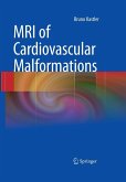 MRI of Cardiovascular Malformations (eBook, PDF)
