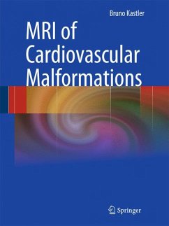 MRI of Cardiovascular Malformations (eBook, PDF) - Kastler, Bruno