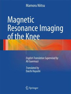 Magnetic Resonance Imaging of the Knee (eBook, PDF) - Niitsu, Mamoru