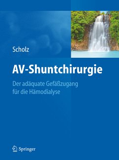 AV-Shuntchirurgie (eBook, PDF) - Scholz, Hans