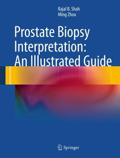 Prostate Biopsy Interpretation: An Illustrated Guide (eBook, PDF) - Shah, Rajal B.; Zhou, Ming