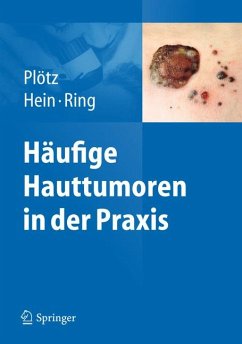 Häufige Hauttumoren in der Praxis (eBook, PDF) - Plötz, Sabine G.; Hein, Rüdiger; Ring, Johannes