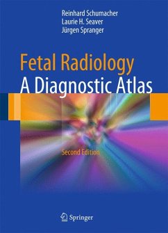 Fetal Radiology (eBook, PDF) - Schumacher, Reinhard; Seaver, Laurie H.; Spranger, Jürgen