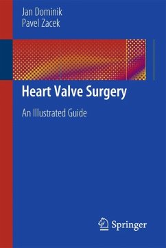 Heart Valve Surgery (eBook, PDF) - Dominik, Jan; Zacek, Pavel