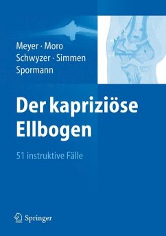 Der kapriziöse Ellbogen (eBook, PDF)