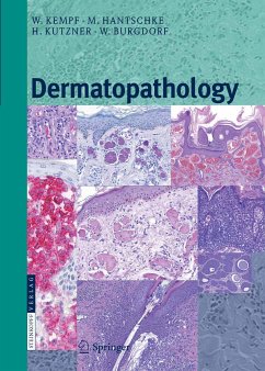 Dermatopathology (eBook, PDF) - Kempf, Werner; Hantschke, Markus; Kutzner, Heinz; Burgdorf, Walter H.C.