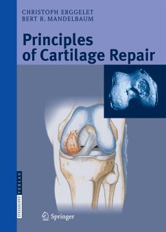 Principles of Cartilage Repair (eBook, PDF) - Erggelet, Christoph; Mandelbaum, Bert R.