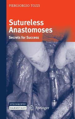 Sutureless Anastomoses (eBook, PDF) - Tozzi, Piergiorgio
