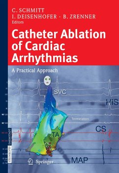 Catheter Ablation of Cardiac Arrhythmias (eBook, PDF)
