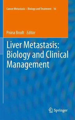 Liver Metastasis: Biology and Clinical Management (eBook, PDF)