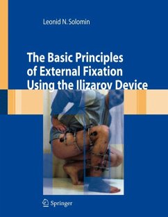 The Basic Principles of External Skeletal Fixation Using the Ilizarov Device (eBook, PDF) - Solomin, Leonid