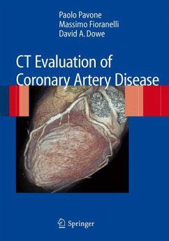 CT Evaluation of Coronary Artery Disease (eBook, PDF) - Pavone, Paolo; Fioranelli, Massimo; Dowe, David A.