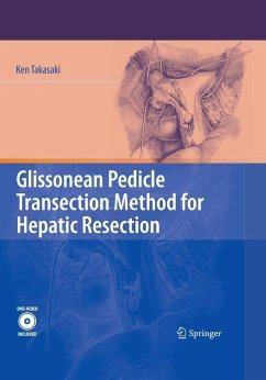 Glissonean Pedicle Transection Method for Hepatic Resection (eBook, PDF) - Takasaki, Ken