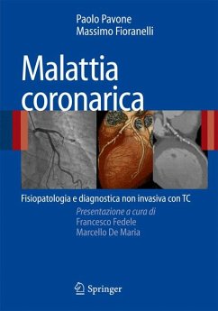 Malattia coronarica (eBook, PDF) - Pavone, Paolo; Fioranelli, Massimo