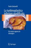 La turbinoplastica inferiore modificata (eBook, PDF)