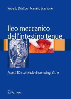 Ileo meccanico dell'intestino tenue (eBook, PDF)