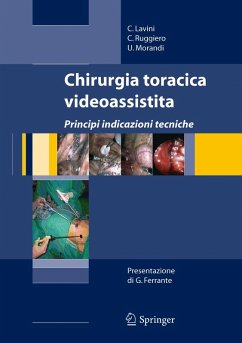 Cover Chirurgia toracica videoassistita (eBook, PDF)