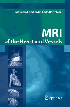 MRI of the Heart and Vessels (eBook, PDF) - Lombardi, Massimo; Bartolozzi, Carlo