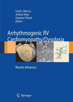 Arrhythmogenic RV Cardiomyopathy/Dysplasia (eBook, PDF)