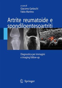 Artrite reumatoide e spondiloentesoartriti (eBook, PDF)