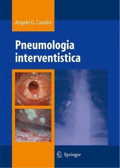 Pneumologia interventistica (eBook, PDF) - Casalini, Angelo