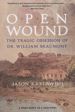 Open Wound: The Tragic Obsession of Dr. William Beaumont - Karlawish, Jason