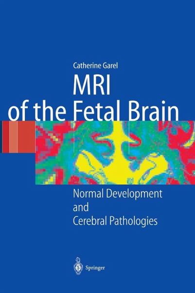 MRI of the Fetal Brain MRI of the Fetal Brain