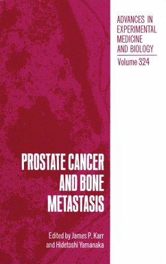 Cover Prostate Cancer and Bone Metastasis