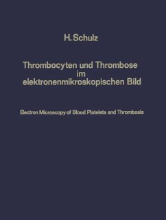 Thrombocyten und Thrombose im elektronenmikroskopischen Bild / Electron Microscopy of Blood Platelets and Thrombosis - Schulz, Heribert