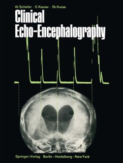 Clinical Echo-Encephalography - Schiefer, Wolfgang; Kazner, Ekkehard; Kunze, Stefan