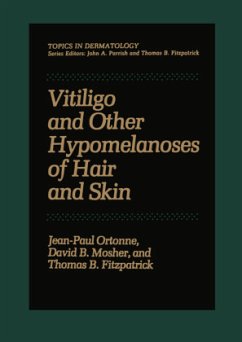 Vitiligo and Other Hypomelanoses of Hair and Skin - Ortonne, Jean-Paul