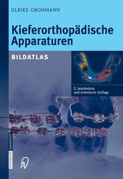 Kieferorthopädische Apparaturen (eBook, PDF) - Grohmann, Ulrike