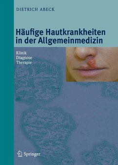 Häufige Hautkrankheiten in der Allgemeinmedizin (eBook, PDF) - Abeck, Dietrich
