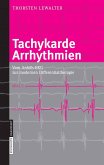 Tachykarde Arrhythmien (eBook, PDF)